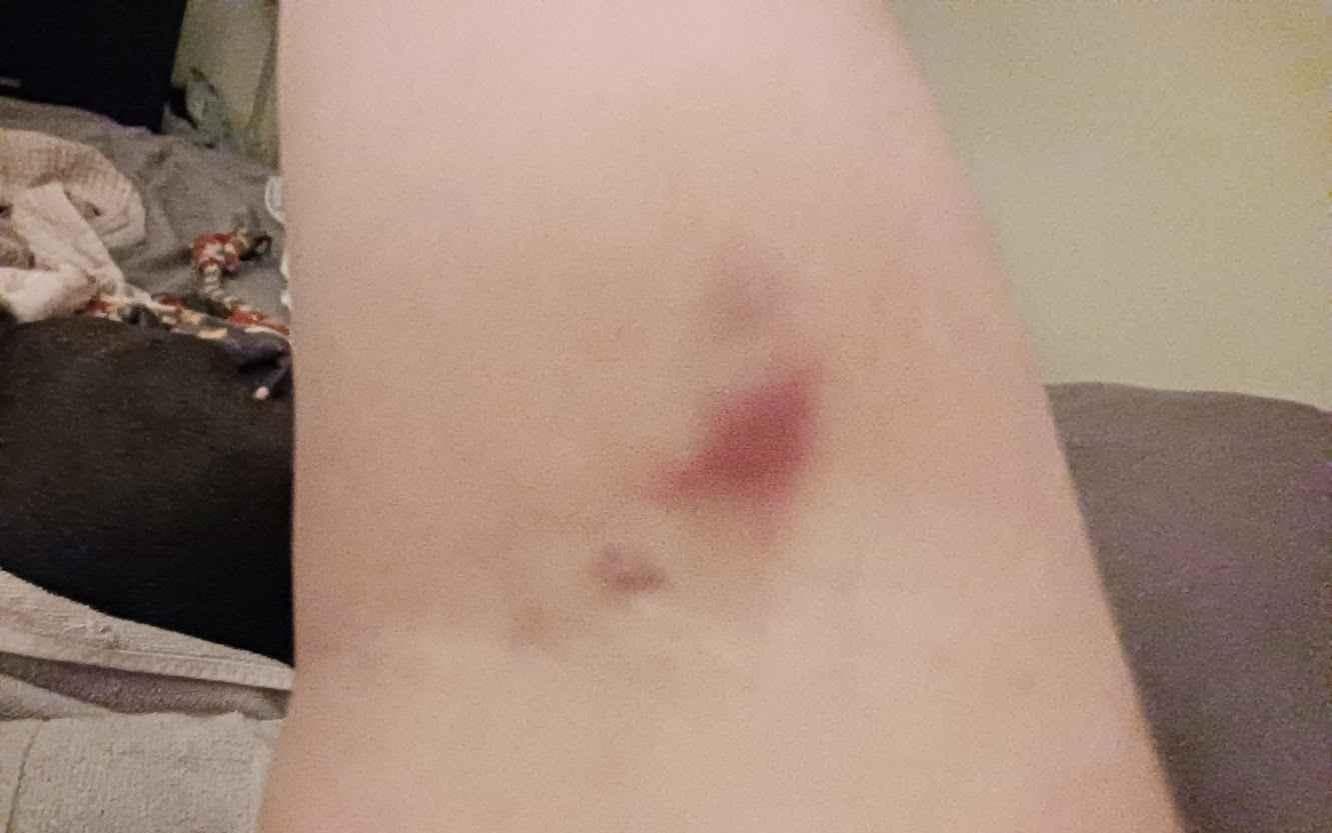 BioLife Plasma Services Bossier City, LA